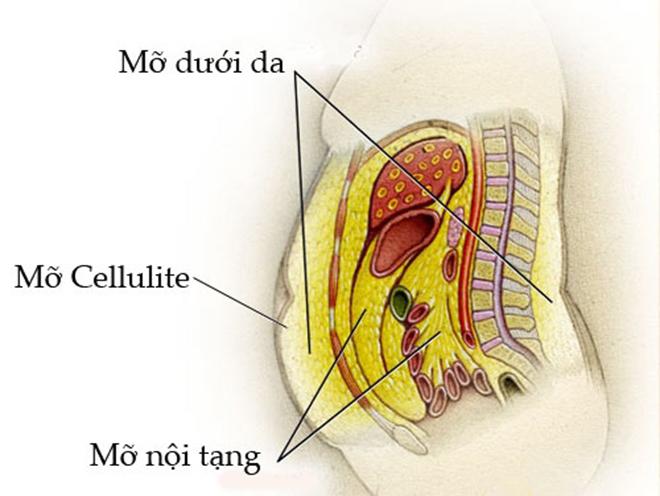 can canh mot ca hut mo bung khien nguoi phu nu cung ran nhat cung phai… bat khoc! - 1